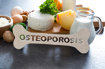 ein Jausenbrett mit Milch, verschiedene Käsesorten, Petersiele; daneben Eier und Nüsse und vorne eine Knochen mit der Aufschrift Osteoporosis